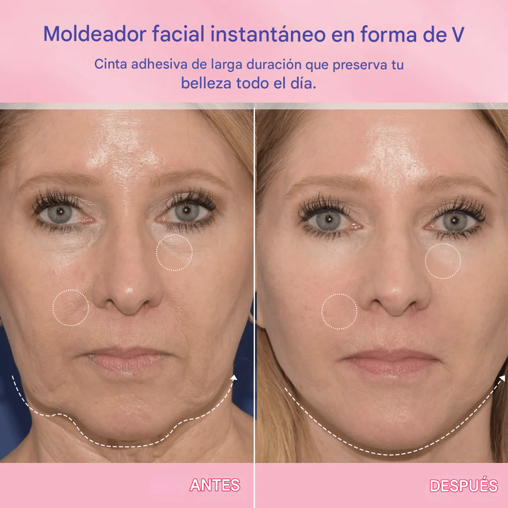 La Cinta Adhesiva Invisible LBMLBM™ V-Face Lifting-