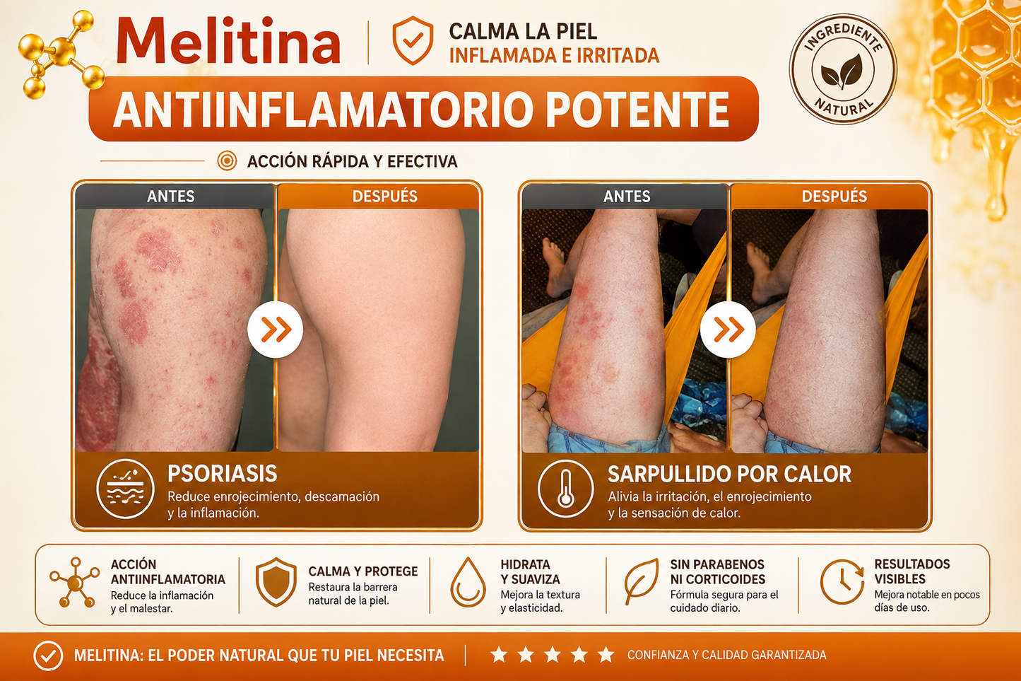 Crema restauradora de piel con veneno de abeja LOVILDS™