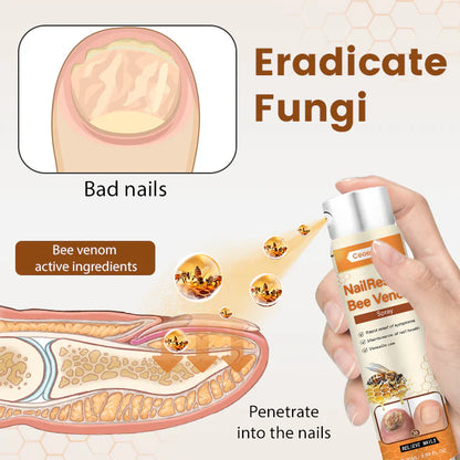 NailRescue Tratamiento para uñas saludables