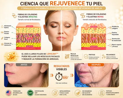 Crema restauradora de piel con veneno de abeja LOVILDS™