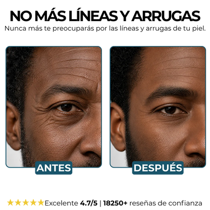 Morge Skin Visiblemente Mas Joven En Dos Semanas 🕶️