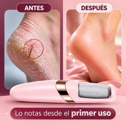 SoftFeet™ ProCare - Removedor Eléctrico De Callos Profesional