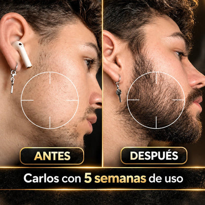 🧔🏻Bálsamo Estimulante De Barba Apolo + Activador : Barba más densa, fuerte y saludable🧴
