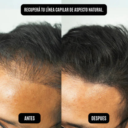 polvo capilar HAIR RICH es mejor que las fibras capilares