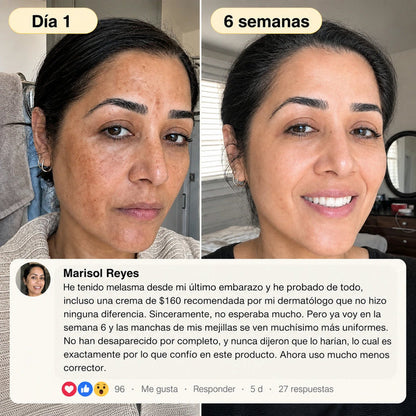Mascarilla Nocturna De Cúrcuma Y Ácido Kójico De Quia