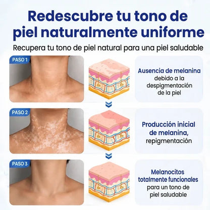 VitiRepair - Spray avanzado para el vitiligo y parches blancos