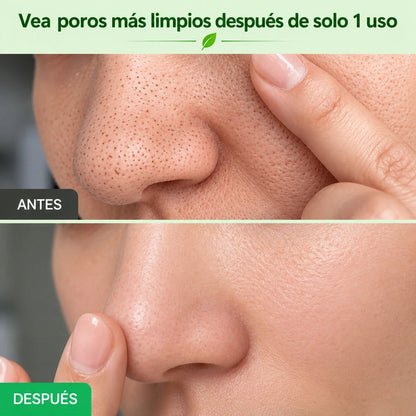 🔥PROMO 2X1 🔥Nueva GREEN TOMATO™ - Limpieza Profunda De Poros Y Puntos Negros ✨
