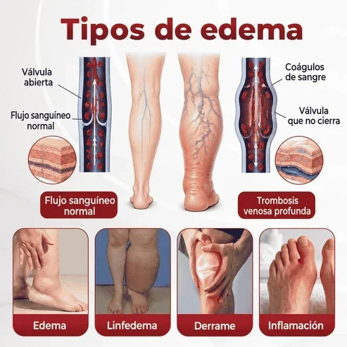 SwellVeil - Crema para la circulación de piernas