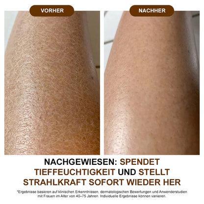 Aceite corporal de seda Zvoevo® ✅ Probado por Dermatest® – Reafirma, suaviza y tonifica la piel