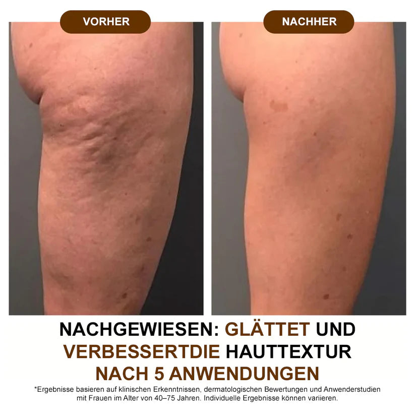 Aceite corporal de seda Zvoevo® ✅ Probado por Dermatest® – Reafirma, suaviza y tonifica la piel