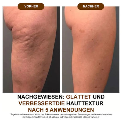 Aceite corporal de seda Zvoevo® ✅ Probado por Dermatest® – Reafirma, suaviza y tonifica la piel