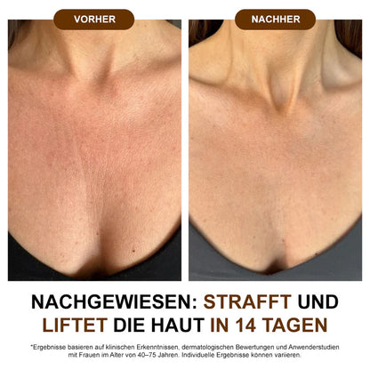 Aceite corporal de seda Zvoevo® ✅ Probado por Dermatest® – Reafirma, suaviza y tonifica la piel