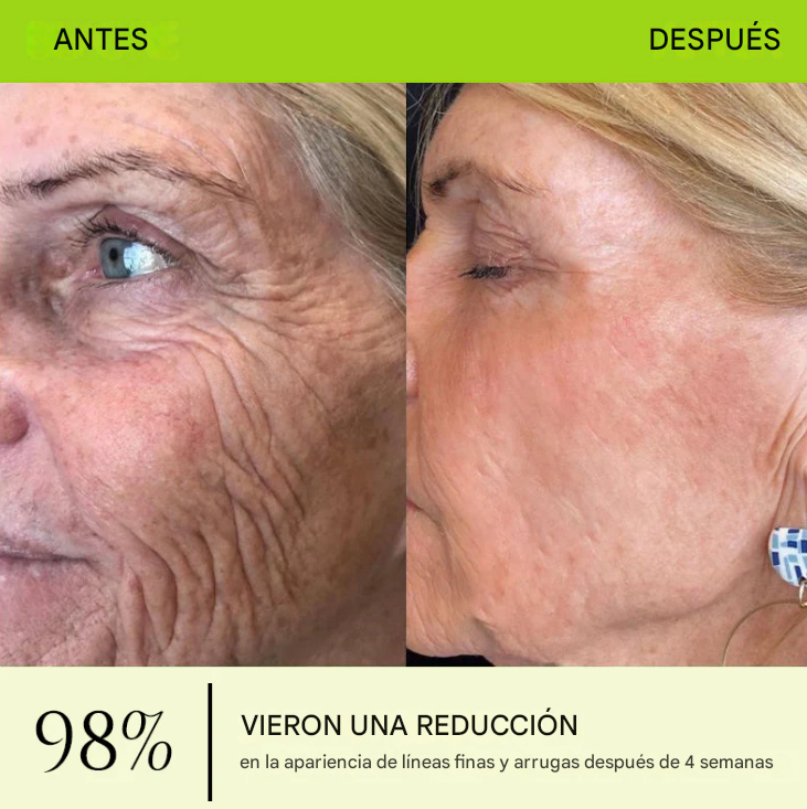 ODALIT™ Botox & Retinol Shot - Borrador de arrugas profundas, flacidez de la papada y ojos hinchados
