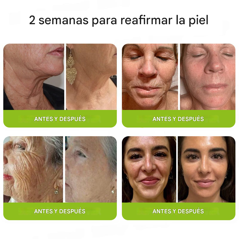 ODALIT™ Botox & Retinol Shot - Borrador de arrugas profundas, flacidez de la papada y ojos hinchados