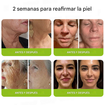 ODALIT™ Botox & Retinol Shot - Borrador de arrugas profundas, flacidez de la papada y ojos hinchados