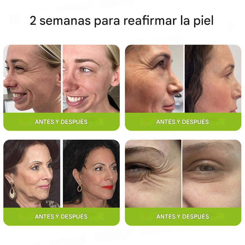 ODALIT™ Botox & Retinol Shot - Borrador de arrugas profundas, flacidez de la papada y ojos hinchados