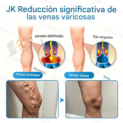 FOUK® Parche de microagujas para la reparación de venas
