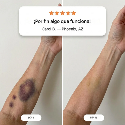 Crema reparadora de hematomas y fortalecedora de la piel LIMETOW®