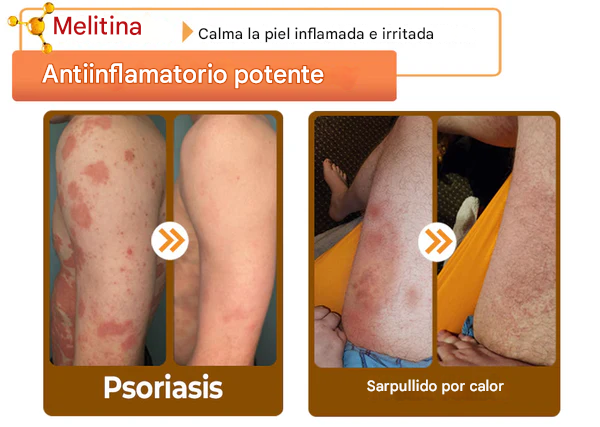 Crema restauradora de piel con veneno de abeja LOVILDS™