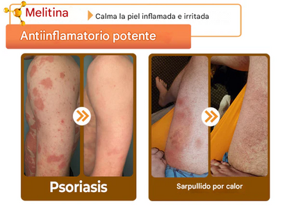Crema restauradora de piel con veneno de abeja LOVILDS™