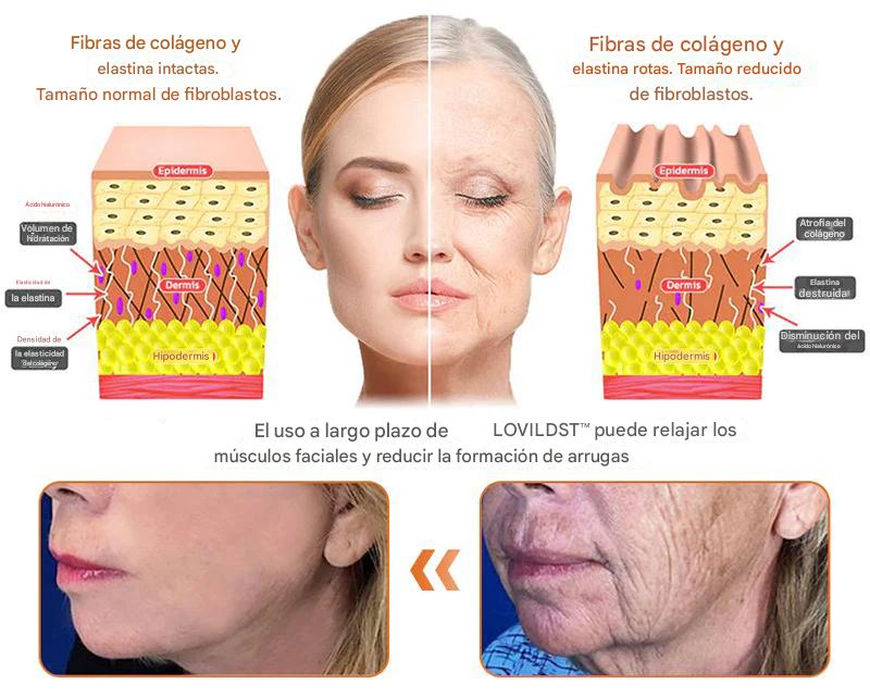 Crema restauradora de piel con veneno de abeja LOVILDS™