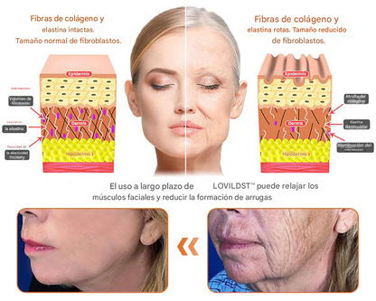 Crema restauradora de piel con veneno de abeja LOVILDS™