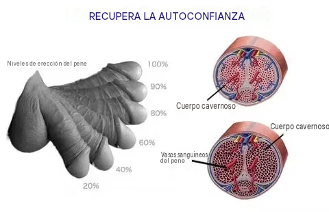 Masajeador De Terapia De Ondas De Choque Ultrasónicas